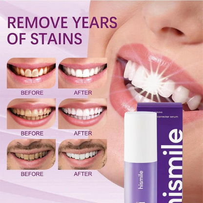 HiSmile Bright Serum