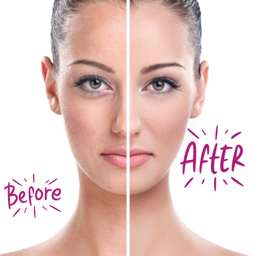 LED Facial Exfoliator Face Hair Remover