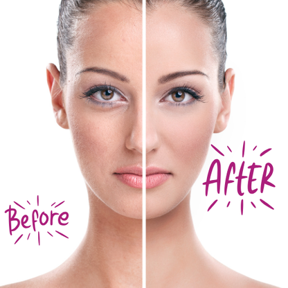 LED Facial Exfoliator Face Hair Remover