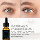 ELHOE Eyelash Growth Serum – 100% Pure Castor Oil