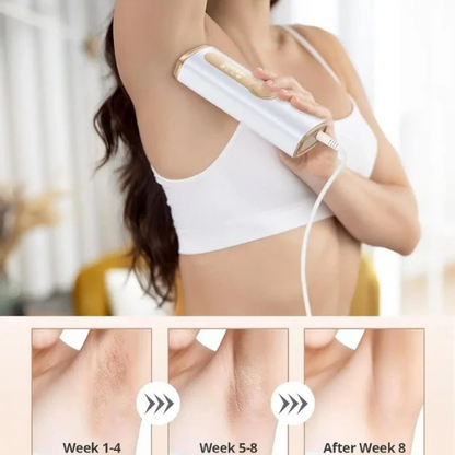 ICE-COOL IPL HAIR REMOVAL – SMOOTH SKIN, ZERO PAIN