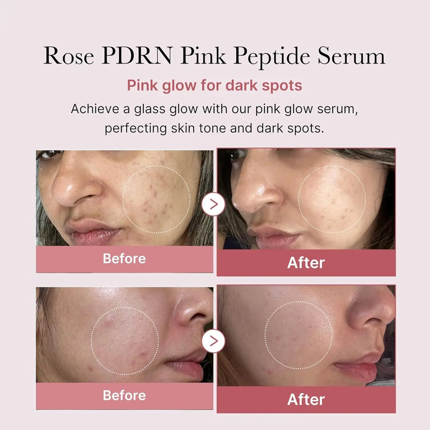 Moisturizing Medicube Pink Essence 30ml