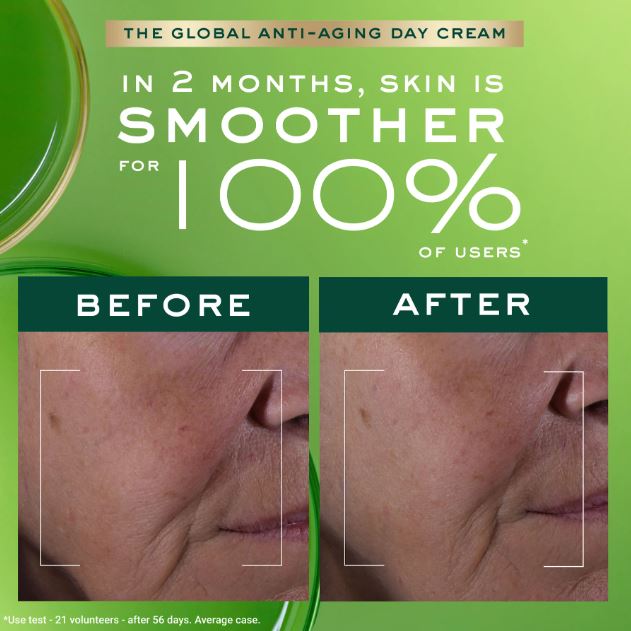 Advertisement for a global anti-aging day cream showing before and after effects on skin.