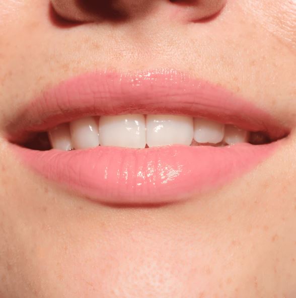 Close-up of a person's lips with a focus on the teeth.